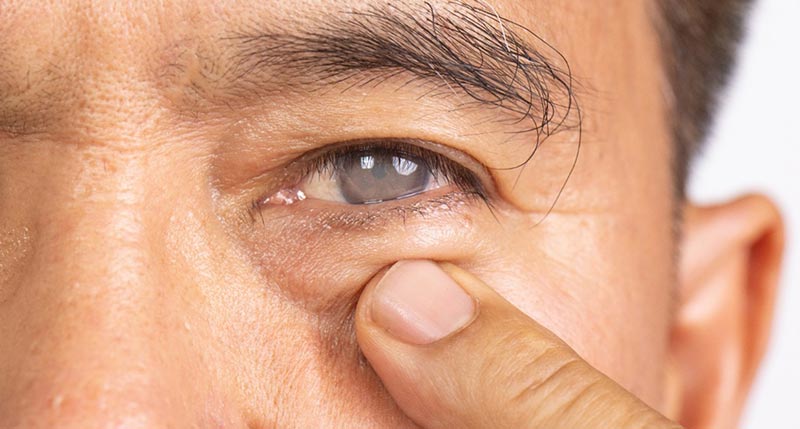 cataract adult pediatric eyecare local eye doctor near you